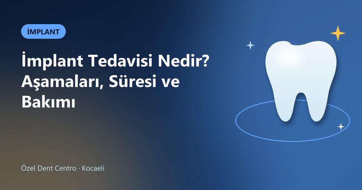 İmplant Tedavisi Nedir? Aşamaları, Süresi ve Bakımı – Dent Centro blog kapak görseli