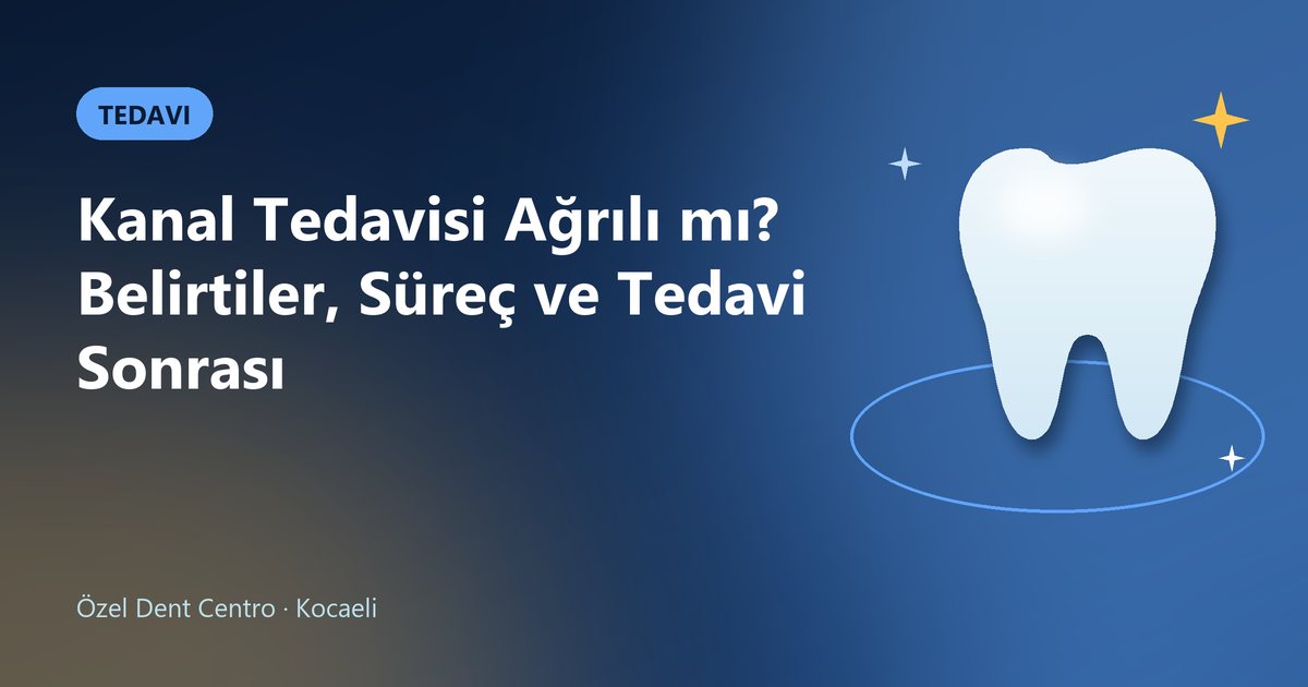Kanal Tedavisi Ağrılı mı? Belirtiler, Süreç ve Tedavi Sonrası – Dent Centro blog kapak görseli